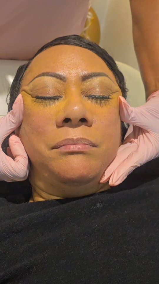 Antiwrinkle Treatments