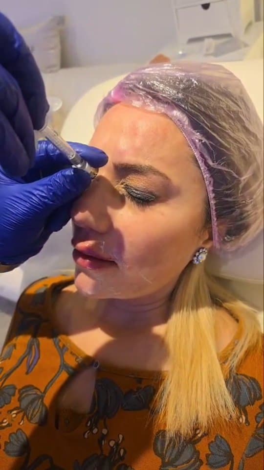 Platelet-Rich Plasma